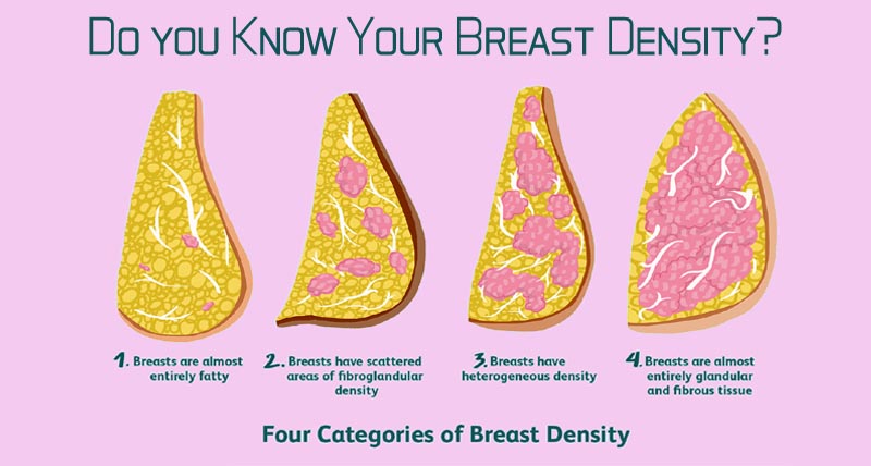 Breast Density