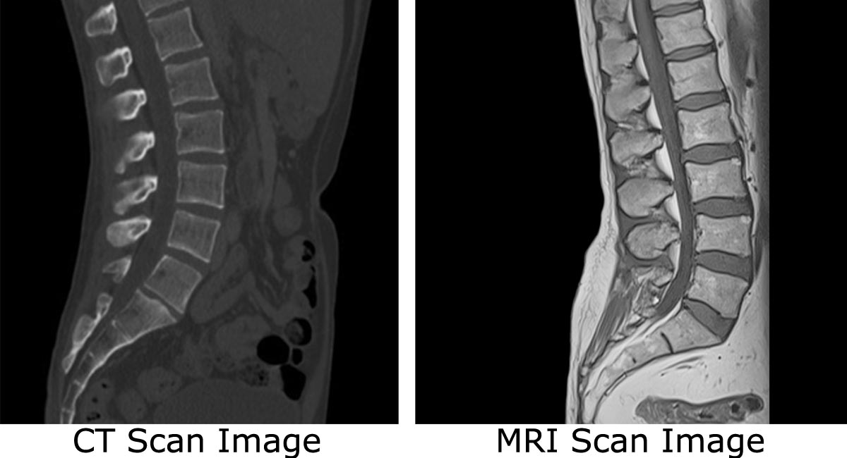 What’s the Difference Between an MRI and a CT